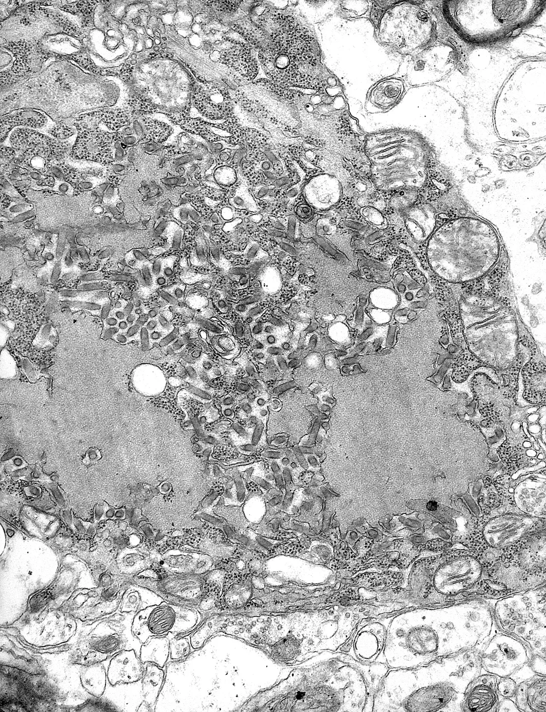Imej mikroskop elektron virus rabies yang dihasilkan pada 1975. Foto Dr Fred Murphy/CDC